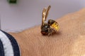 Hornet bites a manÃ¢â¬â¢s hand on a white background